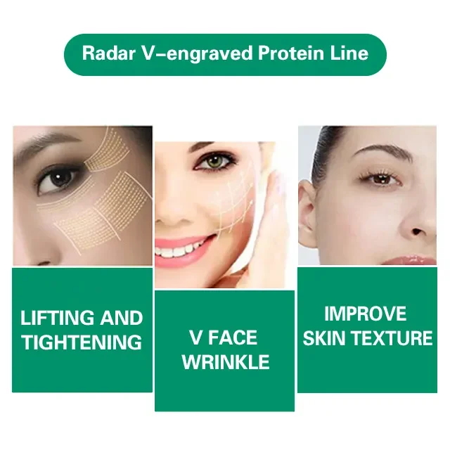 Facial Collagen Thread Lift remove wrinkles Face lifting Tightening Thread Gold Protein Line