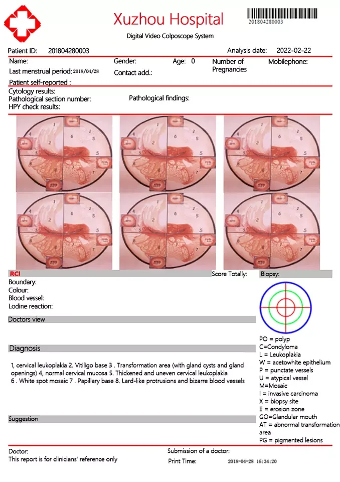 Kernel KN-2200B 2.1MP Video colposcope  HD gynecological colposcope Portable optical Video Colposcope