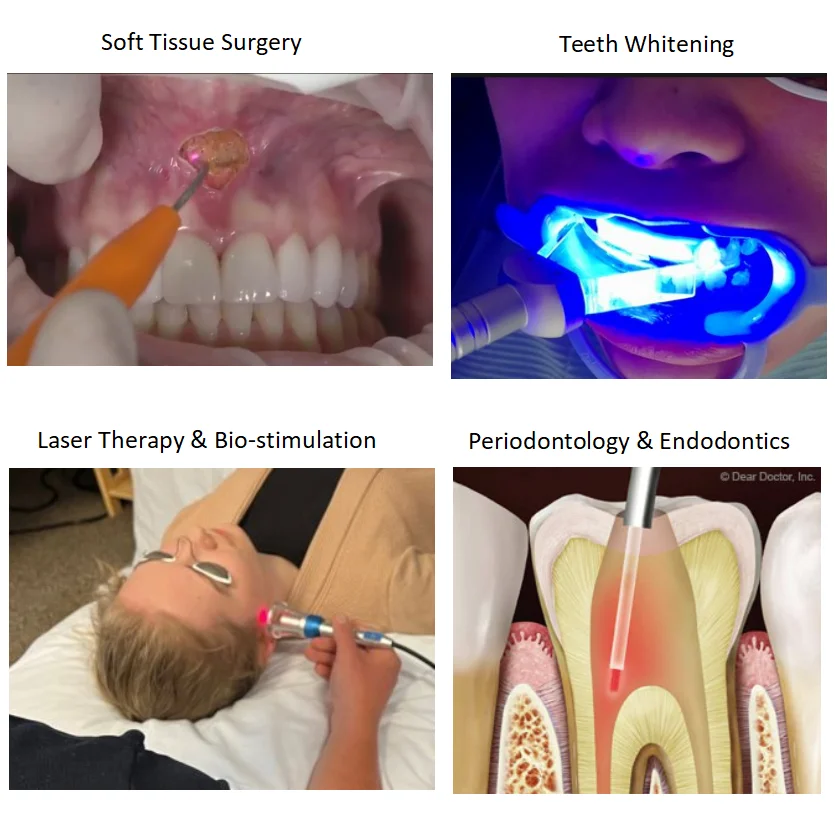 Dental diode laser soft tissue China laser periodontal therapy gum bleaching oral treatment equipments