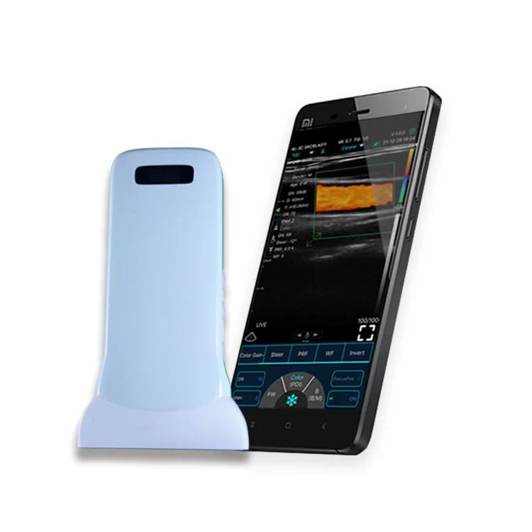 Factory Supply Laptop Wireless Super-width Ultrasonic Hd  Linear Probe for Medical