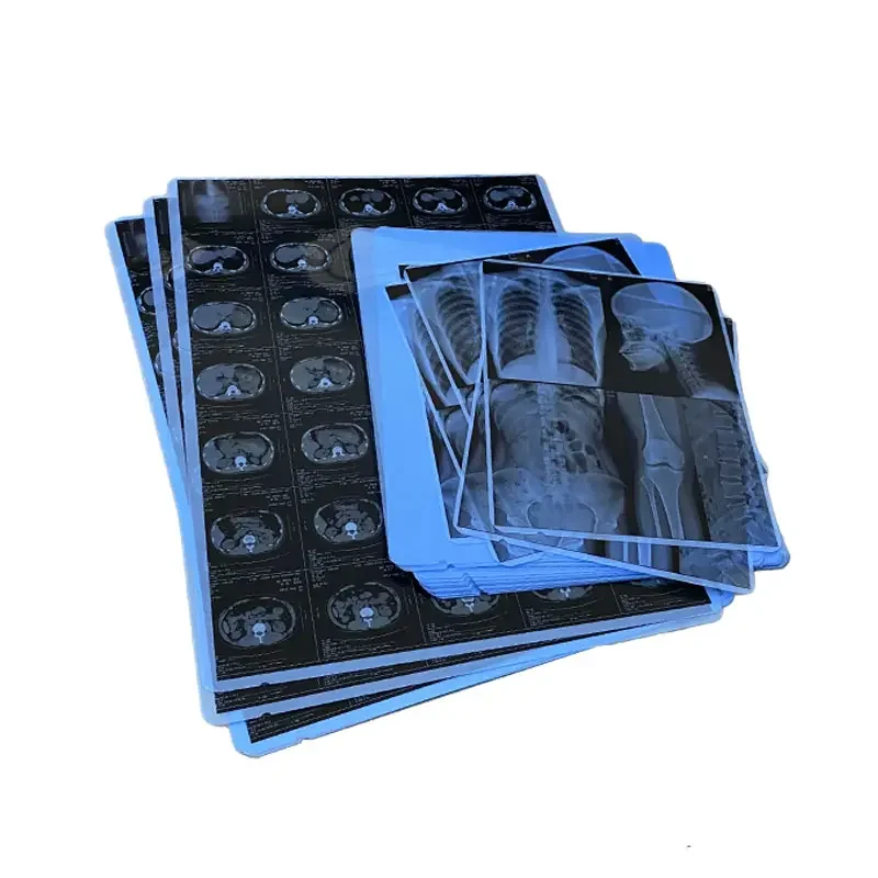 Inkjet Blue Medical dry film transparent blue xray film for CT DR MRI Radiological device
