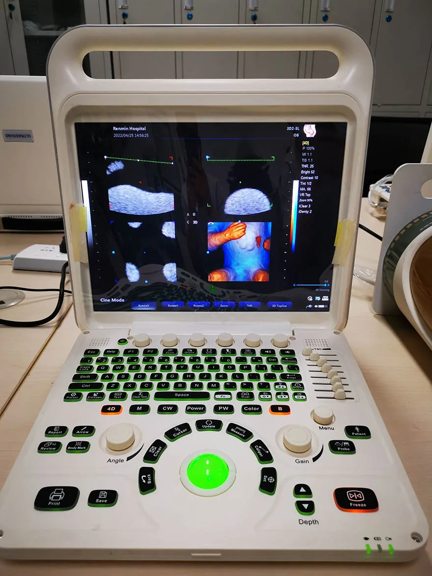 Medical ecografo portatil doppler cardiac 3d 4d ultrasound machine for gynecology
