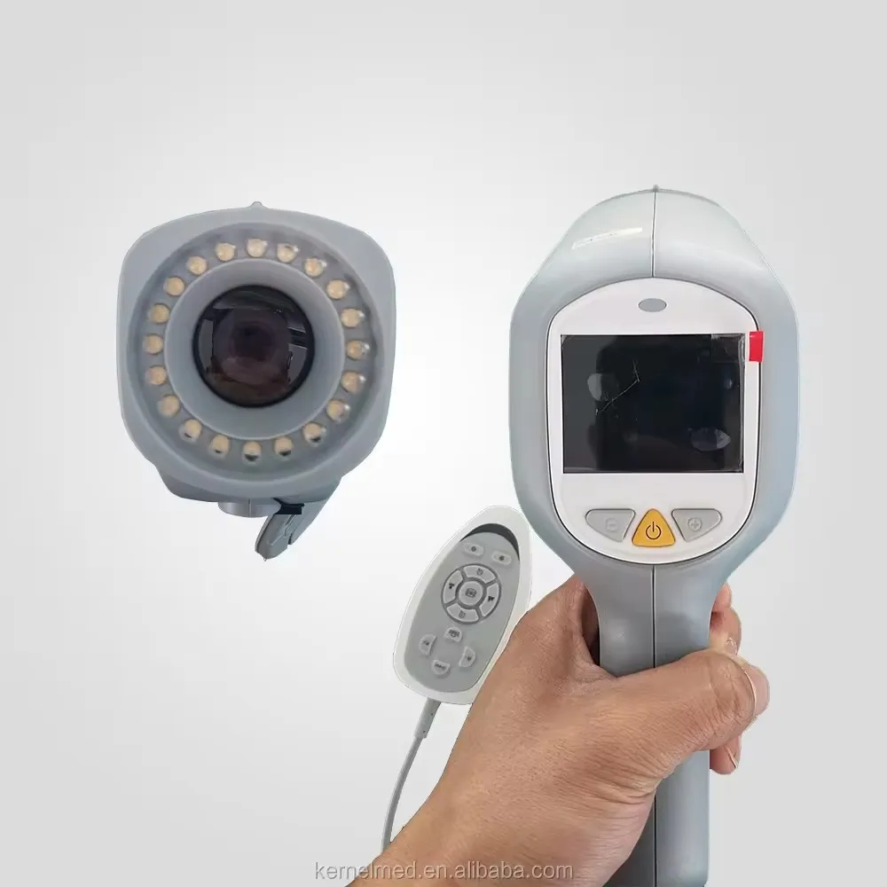 Medical Mobile Digital HD Video Camera CCD Colposcope Device for Vaginal Examination Gynecology