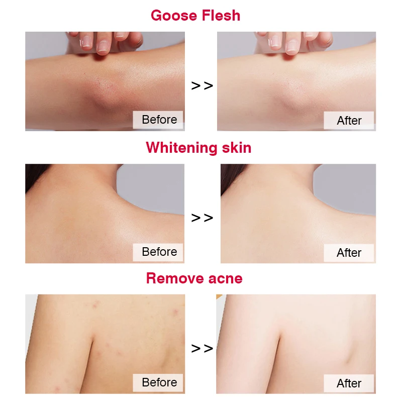 Best Natural Organic Fruit Brightening Hydrating Moisturizer Delicate Skin Extreme Intense Exfoliating Whitening Body Scrub