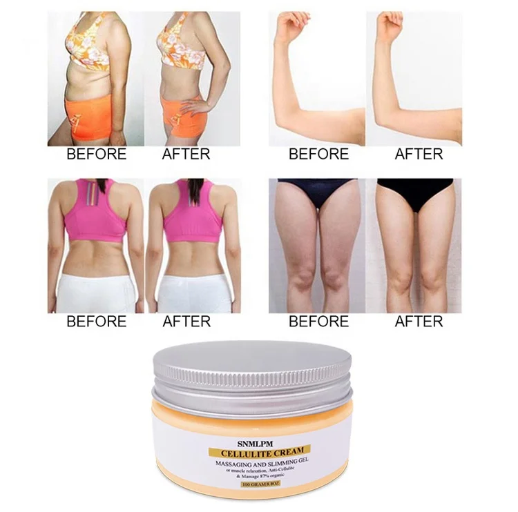 SNMLPM Wholesale Slim Liposuction Body Cream Firming Body Lotion for Women and Men and Body Sculpting Cellulite Workout Cream