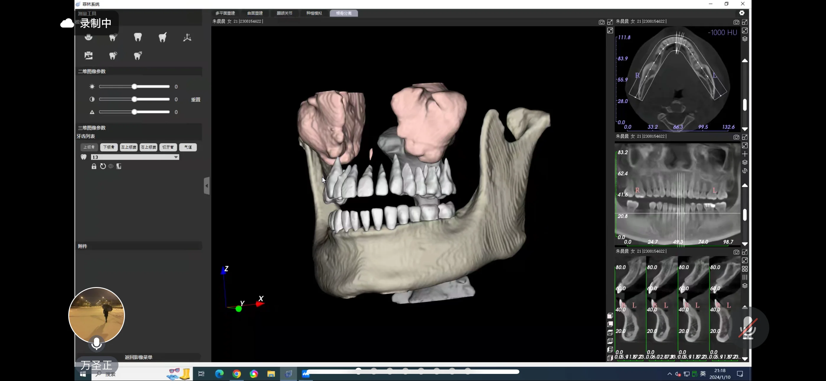 3D Medical Equipment Multifunctional CbCT X-ray Dental
