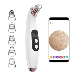 20X Microscope App Visual blackhead remover 2021 Replaceable blackhead remover vacuum with camera
