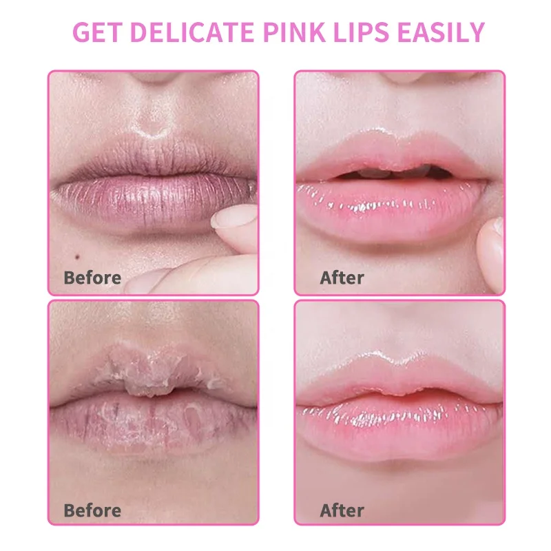 Private Label Pink 24K Gold Hydrating Lip Patch Collagen Lipmask Plump Lip Sleeping Mask