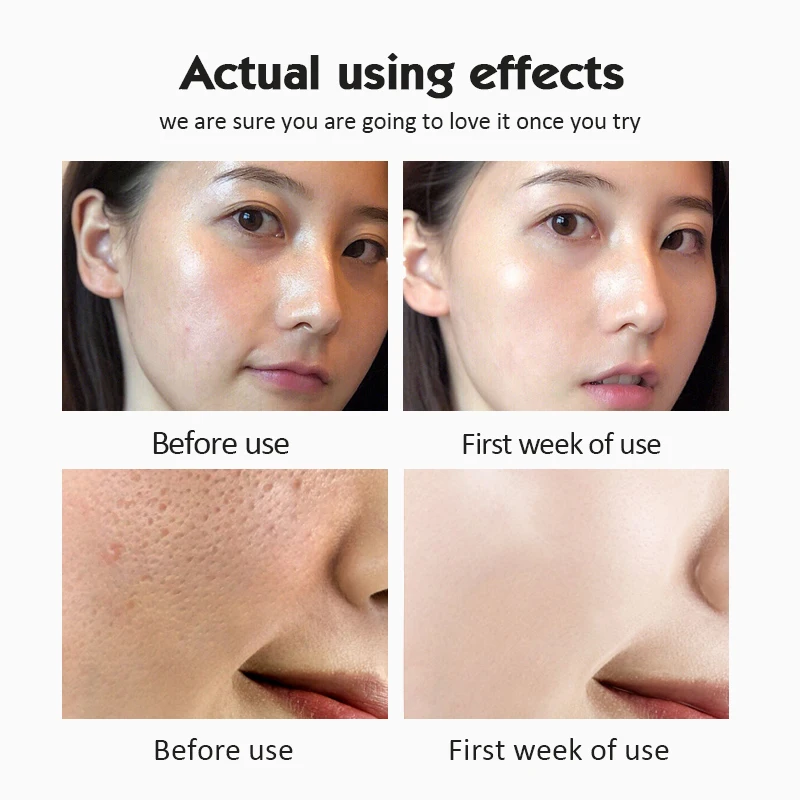 Hot Sale 10% Nicotinamide Ampoule Serum 28 Bottles Vitamin C B3 Whitening Anti Aging Dry Skin Moisturizing Ampoule Serum