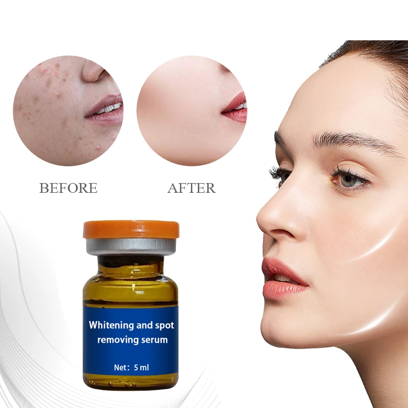Face whitening and freckle removing skin care essence Dark spots face anti-aging essence