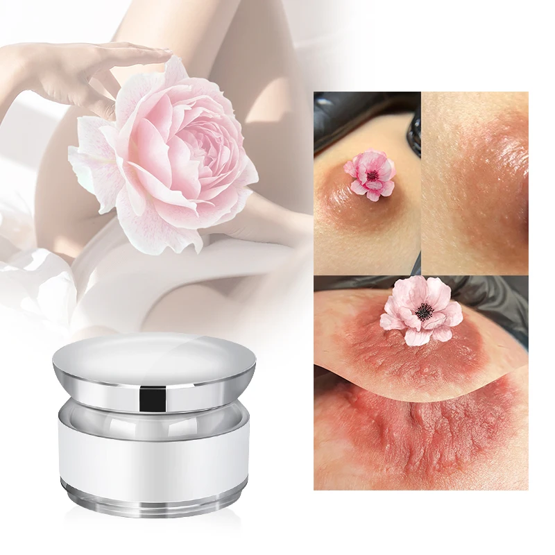 Deep Nourishment Private Parts Pink Tender Cream Intimate Pink Tender Skin