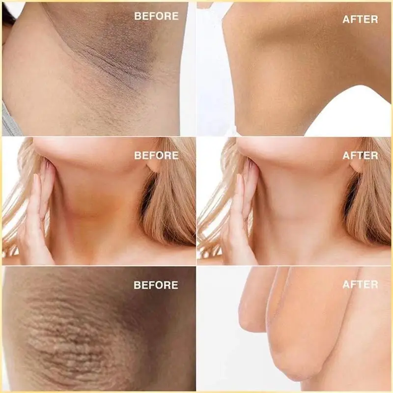 Kojic Acid Soap (5).jpg