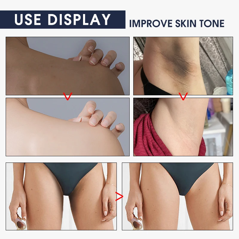 The Neck Whitening Creams Dark Remove Moisturizer Lightening and Organic Collagen Arabic Whitening Beauty Cream