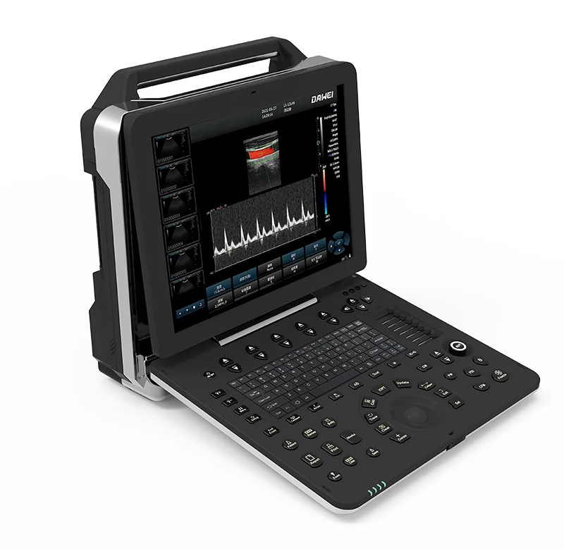 Portable Medical Ultrasound Instruments Ultrasonic Machine Pregnancy Test 3D/4D/5D Color Doppler