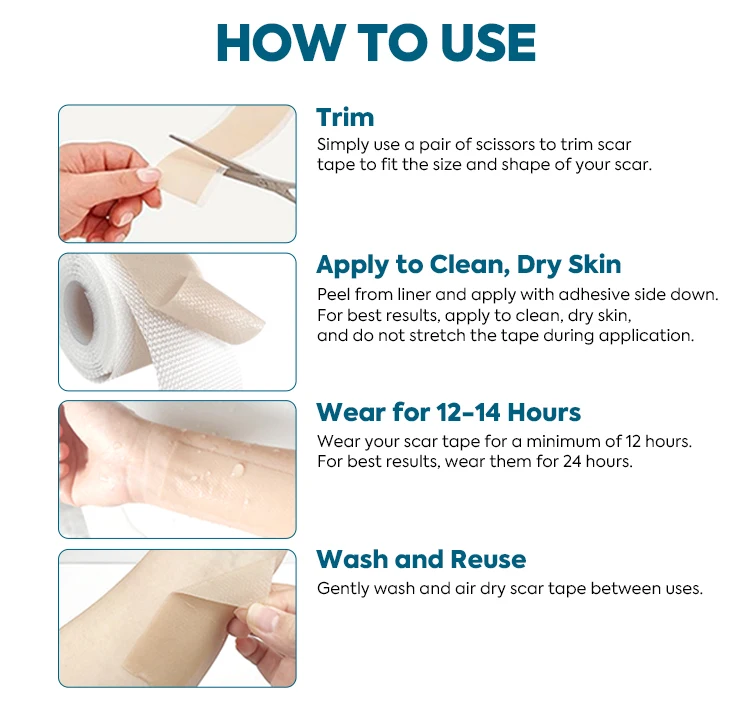 Gel Scar Sheet Reusable Silicone Silicone Sheets For Scars
