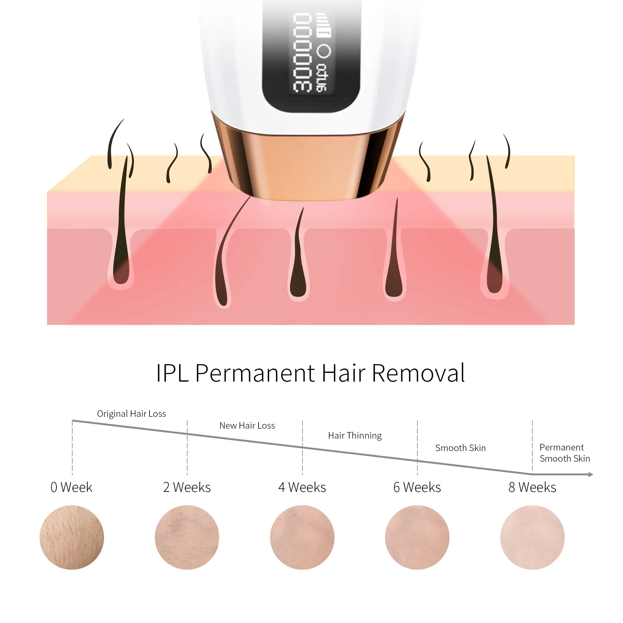 COSBEAUTY Wholesale Ipl Epilator Permanent Professional Laser Removal Electric Painless Remover Machine