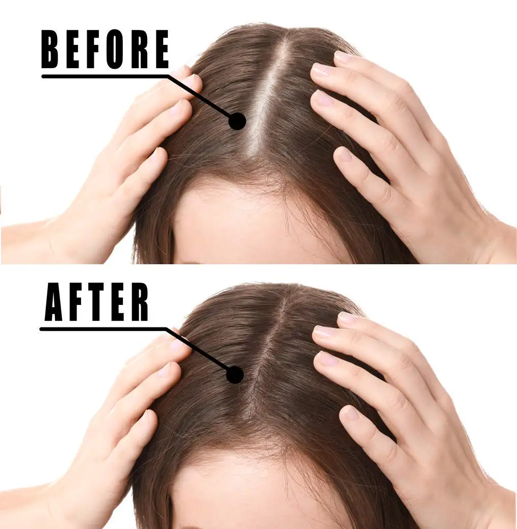 High Quality Anti Itching Hair Ginger Shampoo Hair Loss and Conditioner Sulfate Free Set of 2