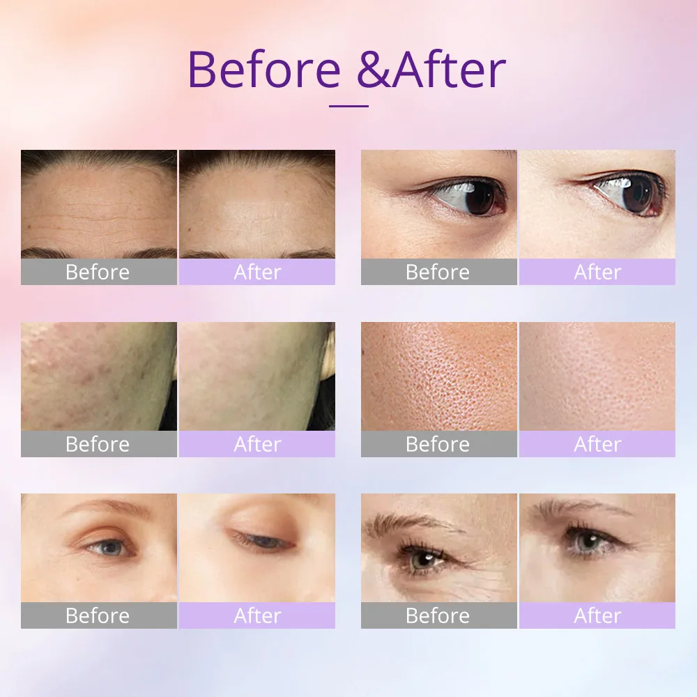 USA Stock 2 IN 1 Photon LED Skin Rejuvenation Photon Micro Current Faccial Whitening Massage Wrinkle Remove Beauty Device