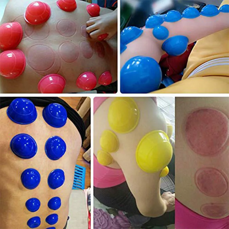new silicone cupping1.jpg