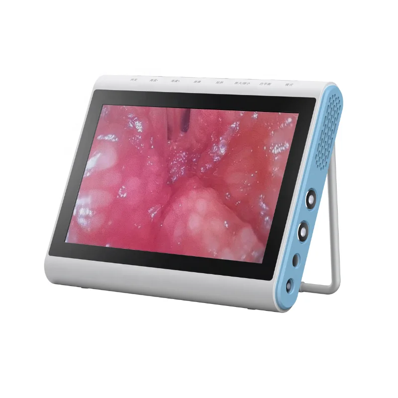 Medical Grade Monitor BESDATA Smart Medical image Processor for Laryngoscope Gastroscope Rhinoscope Bronchoscope Endoscope