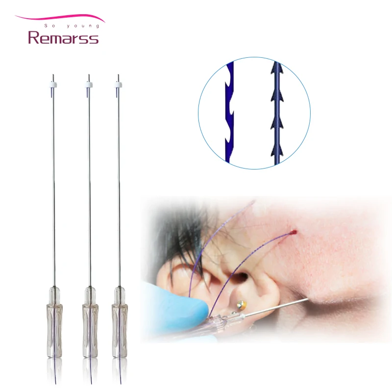 hilos tensores W Cannula Molding Cog Z Type 18g 19g 100mm Strong Face Lifting Pcl Plla Thread Pdo