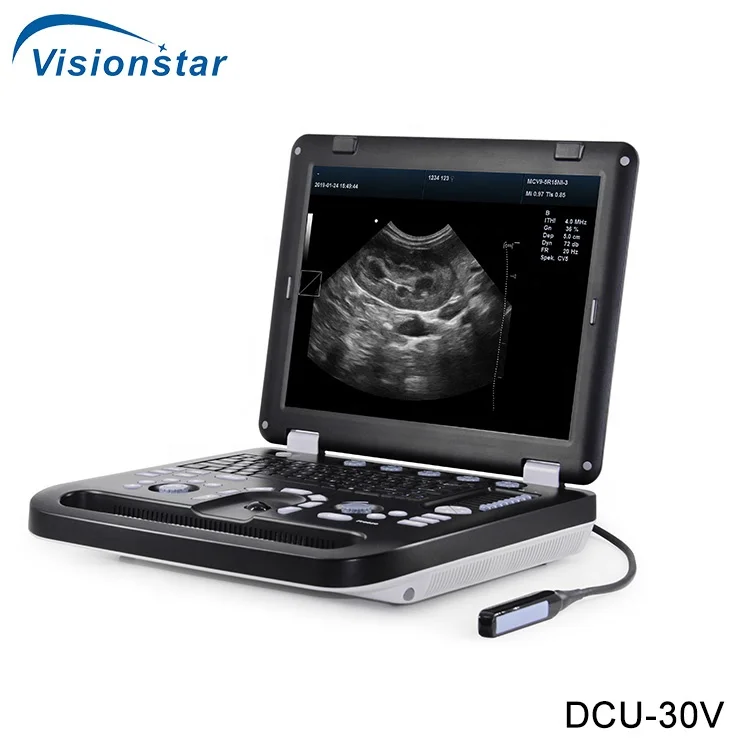 
DCU-30V Portable Color Doppler Pet Ultrasound Machine 