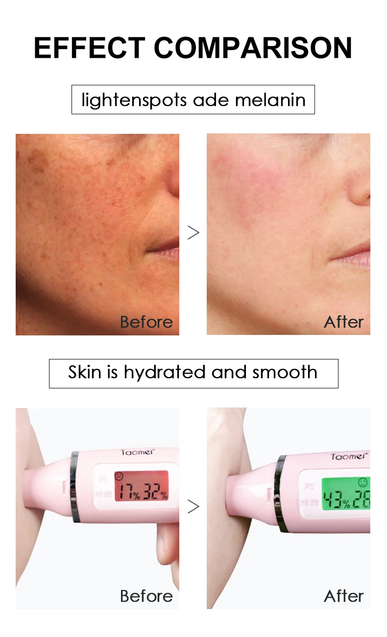 Moika Direct Manufacturer Orange VC Aloe soft skin Deep moisturizing Sodium Hyaluronate Whitening face beauty facial mask