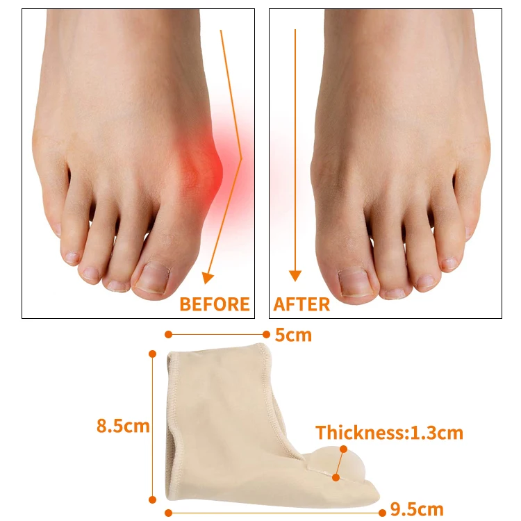 Удобные мягкие корректор для большого пальца стопы протектор Выпрямитель силиконовый исправление вальгусной деформации первого разделитель пальцев ноги забота о ногах