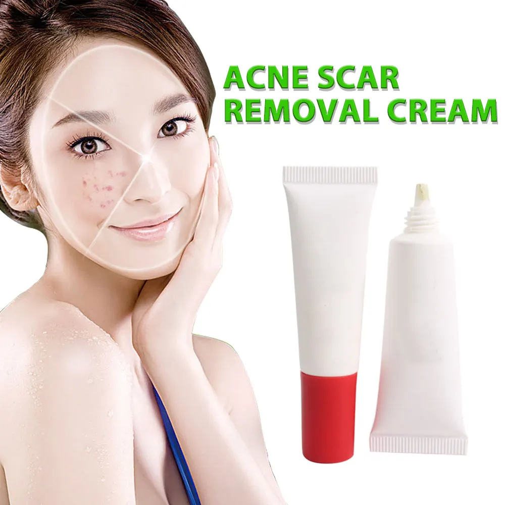 OEM Whitening Correct Red Tinted Acne Removal Treatment Serum Face Anti Acne Cream Repair