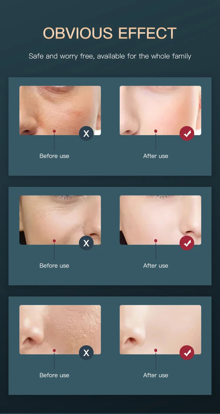 2024 Promotion Price Portable Rf Lifting Skin Care Anti Aging Device High Quality Deep Cleaning Skin Tightening Face Care Device