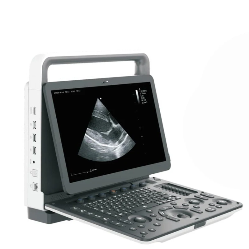 Ysenmed YSB-M70V veterinary color doppler ultrasound system