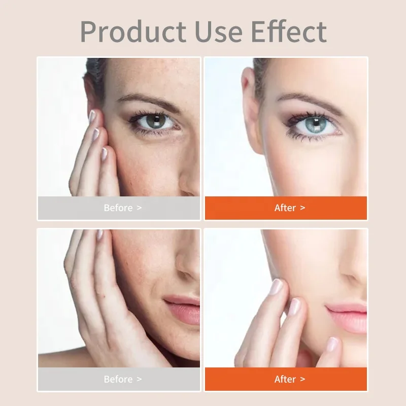 Private Label Pore Cleansing Exfoliating Moisturizing Face Wash Organic Turmeric Facial Gel Cleanser