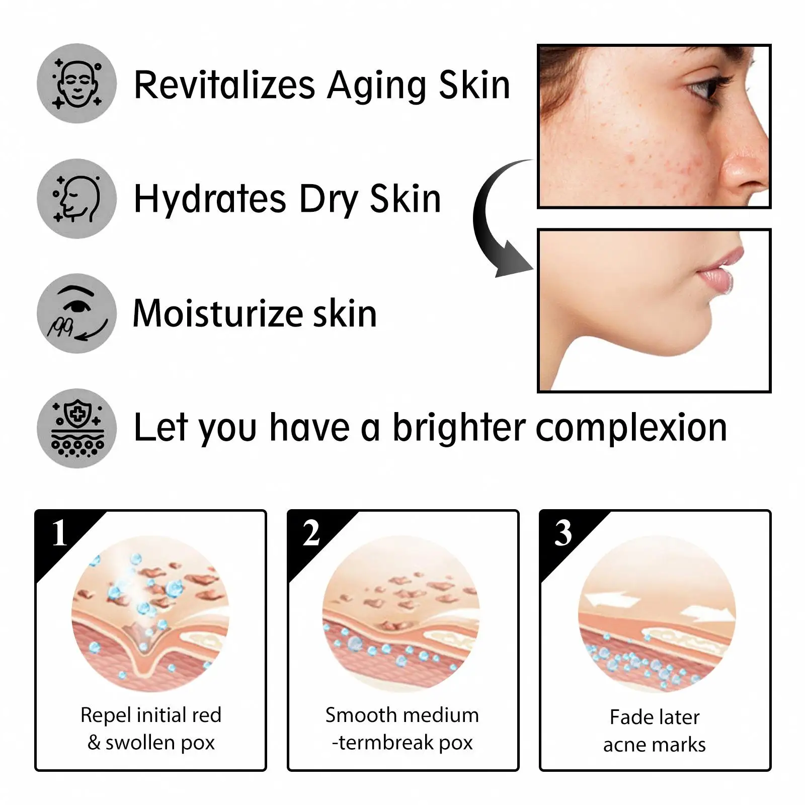 Best-selling  Facial Moisturizing Cream  Anti Acne Face Cream  Korean Face Cream  Factory Wholesale