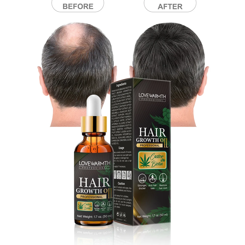 Best Regrowth Hair Oil Private Label Vegan Organic Nourishing Hair Care Product Fast Hair Growth Oil