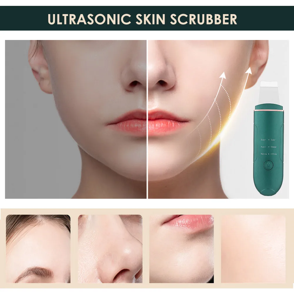 Ultrasonic Face Skin Scrubber USB Charging Facial Cleaner Vibration Blackhead Removal Exfoliating Iron Cleaner Skin Scrubber