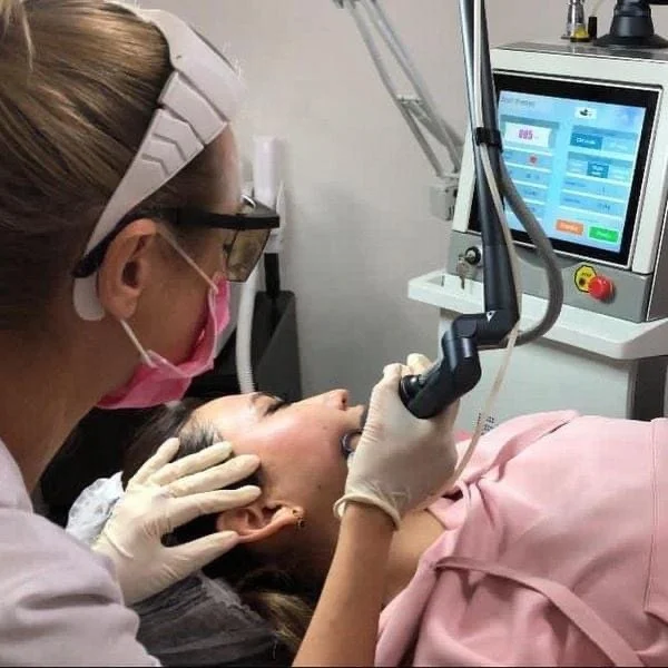 Sincoheren top popular professional tattoo removal pigmentation removal machine q switched nd yag laser device with CE approved
