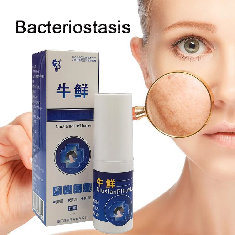 ZB Psoriasis Spray Herbal Extracts Dermatitis Eczema Ointment Psoriasis Skin Care Antibacterial Spray