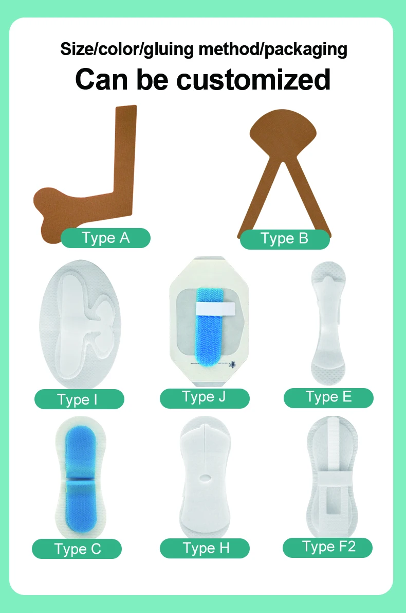Китайские поставщики медицинских услуг стерильные повязки для ран марлевые тампоны островные медицинские ленты ухода за ранами