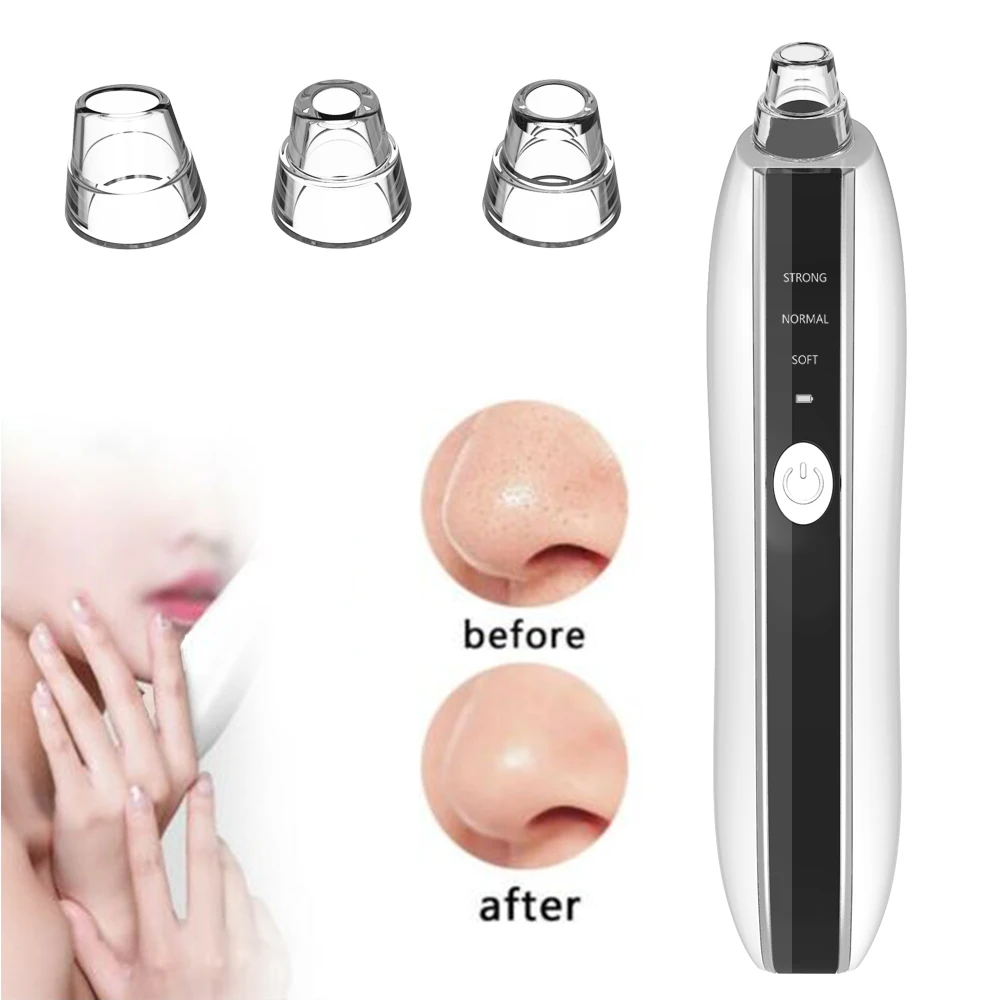 Rechargeable Custom Electric Portable Facial Visual Camera Heating Nose Face Pore Acne Deep Cleansing Blackhead Remover