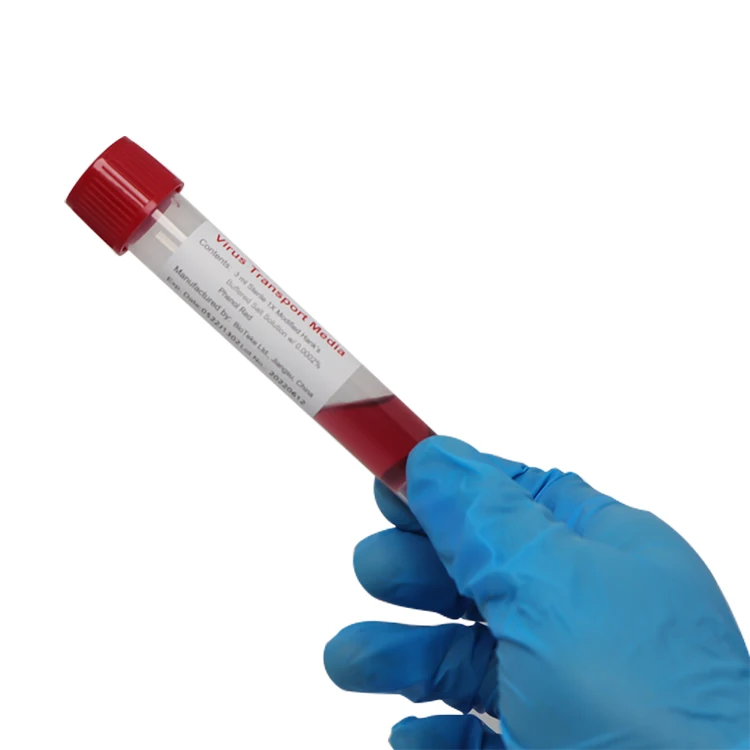 Custom Logo Rapid Test Swab Vtm Kit Flocked Nylon Buccal Swab Stick Kit