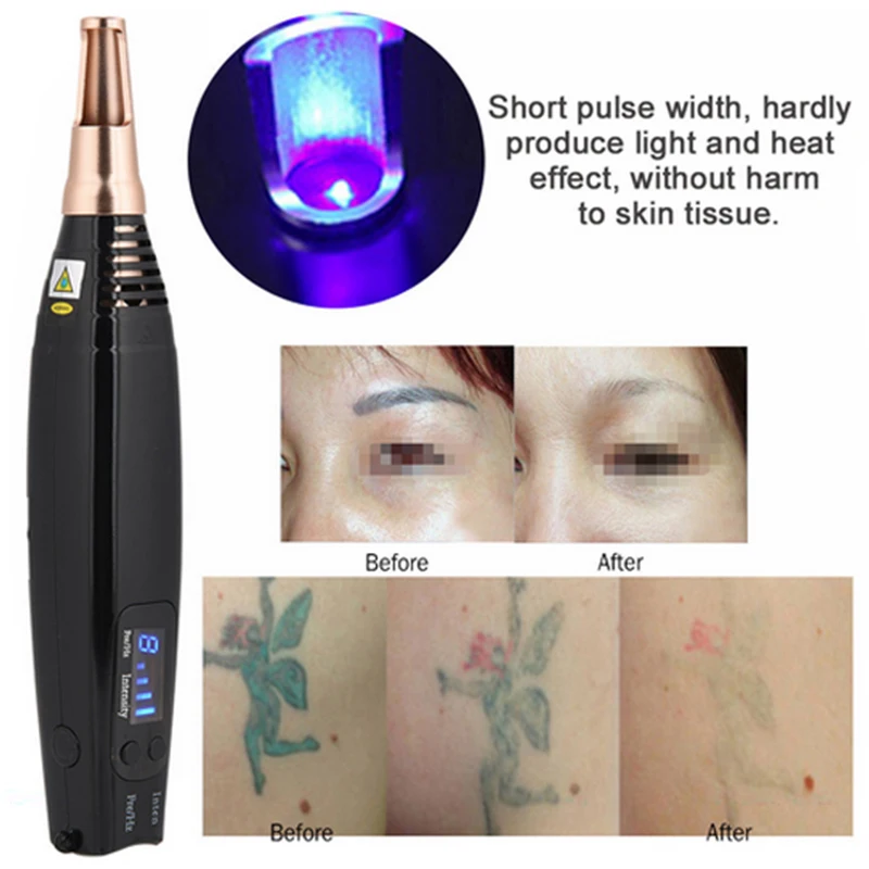 Professional Laser Picosecond Pen Tattoo Removal Laser Pen Blue&Red LED Light Freckle Acne Mole Dark Spot Pigment Beauty Machine