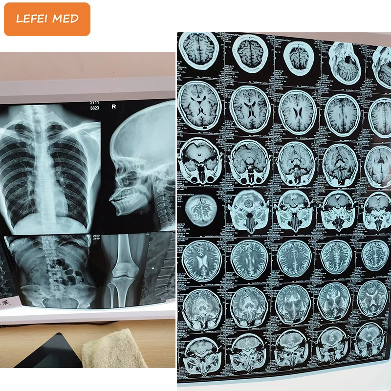 LF6602 Hospital DR system Used agfa drystar 5302 printer medical x ray film digital xray printer laser printer medical dry film