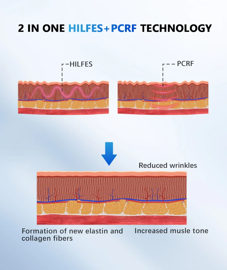 Professional PEFACE Pe Face Vline Face Electromagnetic Radio Frequency rf Release Neck Muscles Eyes Lifting Anti-Aging Machine