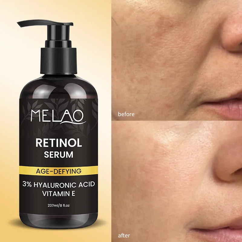 Private Label Paraben Free Face Body Care Skin Moisturizing Anti Aging Vegan Organic Hyaluronic Acid Retinol Face And Body Serum