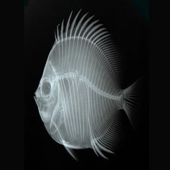 China Kenid Medical dry X-ray films 10*12inch thermal blue dry X-ray digital printable films