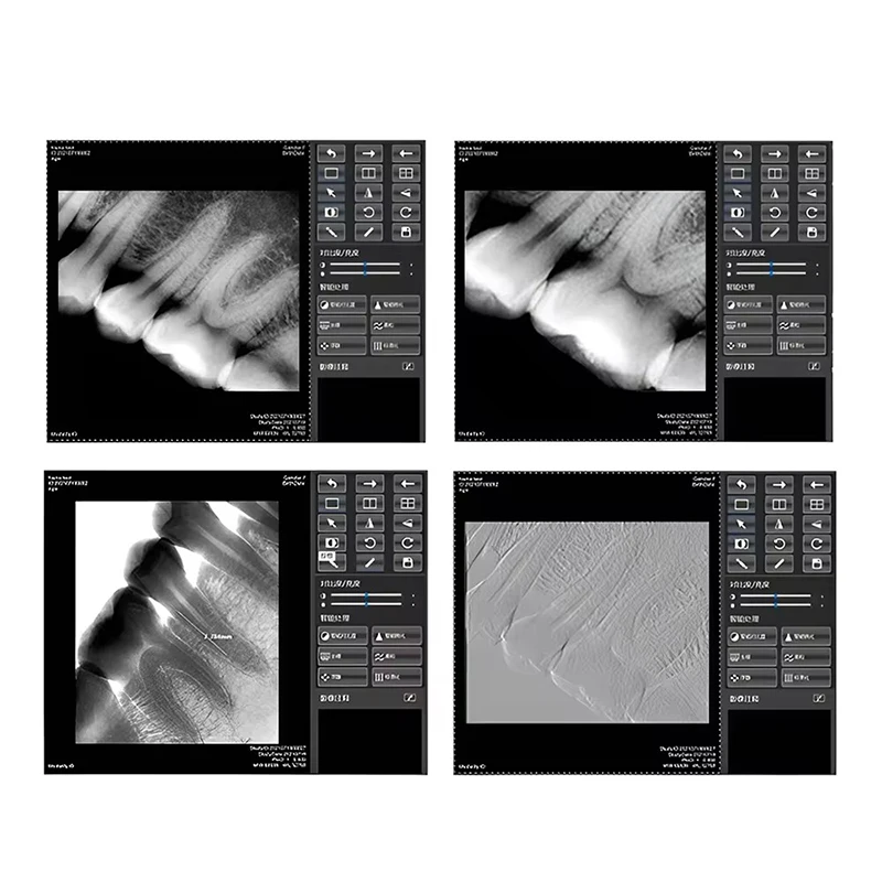 Medical Equipment Portable Digital Dental X-ray Machine With  RVG Sensor Handheld X Ray Unit Intraoral Imaging Sensor