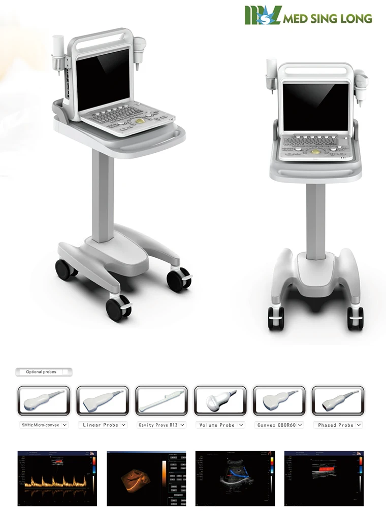 Portable Full-Digital Ultrasound Machine with Electric Power Source Medical Plastic Portable Ultrasound Scan