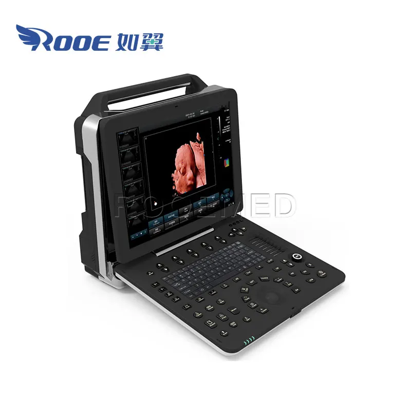 USC300PRO Medical Portable Scan Cardiac Color Doppler Ultrasound