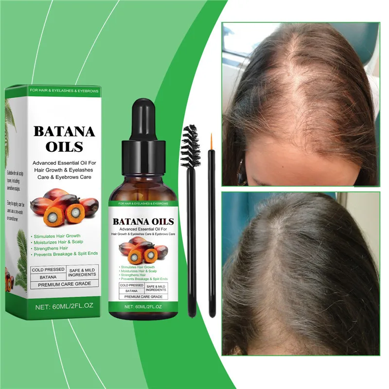 Натуральное эфирное масло с логотипом на заказ органическое батана для роста волос ухода за ресницами и бровями