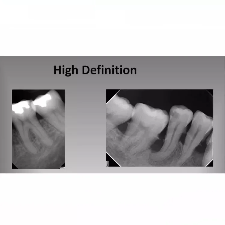 high quality RSV5 rvg digital xray sensor dental with cheap price